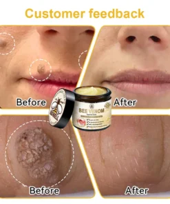 BSWELL™ Bee Venom Skin Treatment Cream