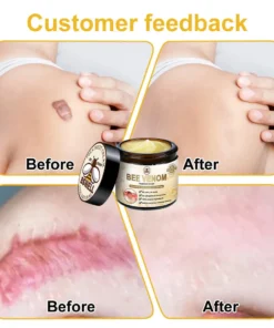BSWELL™ Bee Venom Skin Treatment Cream