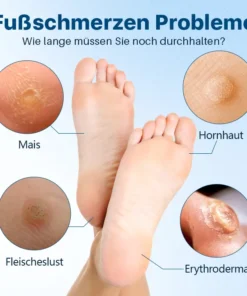 Biancat™ FußGlow Pro-Stärke Hornhaut- und Schwielenentferner-Gel