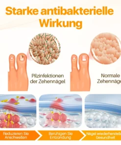 Biancat™ Psoriasis Anti-Bakteriellen Creme