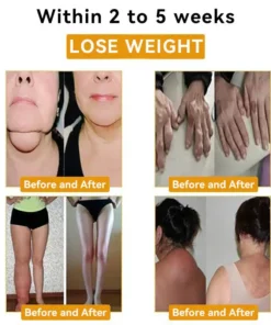 CZTICLEโข ๐๐ฅ๐ญ๐ซ๐๐ฌ๐จ๐ง๐ข๐ ๐
๐๐ญ ๐๐ฎ๐ซ๐ง๐ข๐ง๐ ๐๐ง๐ ๐
๐๐ซ ๐๐ง๐๐ซ๐๐ซ๐๐ ๐๐ฅ๐จ๐จ๐ ๐๐ฎ๐ ๐๐ซ ๐๐๐ฅ๐๐ง๐๐ข๐ง๐ ๐๐๐ญ๐จ๐ฑ ๐๐ซ๐๐๐๐ฅ๐๐ญ