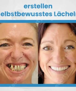Ceoerty™ ComFit Silikon-Prothesenset
