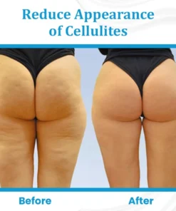 Ceoerty™ EternaLIFT Ultra Firming Skin Cream