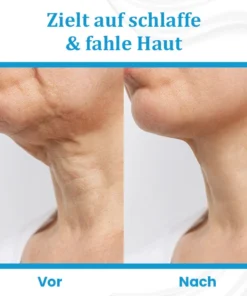Ceoerty™ EternaLIFT Ultra Straffende Hautcreme