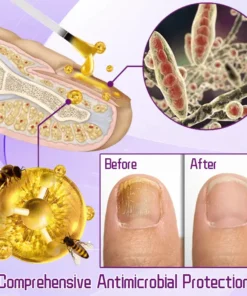 FLYCARE™ FungiGuard Bee Venom Toenail Serum