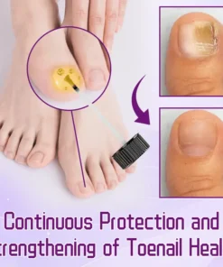 FLYCARE™ FungiGuard Bee Venom Toenail Serum