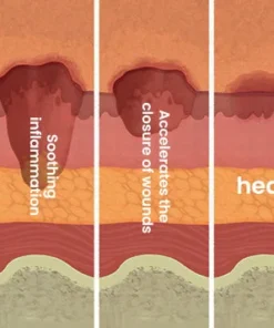 FLYCARE™ Diabetic Wounds Healing Ointment