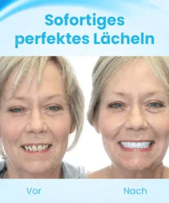 Fivfivgo™ FlexYoSmile Silikon-Prothesen-Set