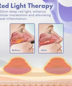 Fivfivgo™ RespiEase Nasales Lichttherapiegerät