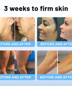 Flysmus® Skin Firming Cream