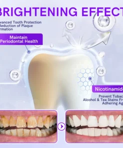 Furzero™ V34 Purple Teeth Whitening Toothpaste