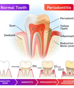 Furzero™ V34 Purple Teeth Whitening Toothpaste
