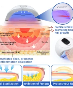 Furzero™ Advanced PureNail Fungus Laser Device