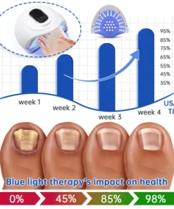 Furzero™ Advanced PureNail Fungus Laser Device