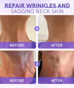 Furzero™ Tighten & Lift Neck Cream