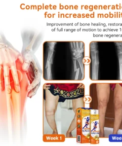 Furzero™ Turmeric Arthritis Spray