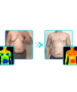 GFOUK™ MenTight Tourmaline Gynecomastia Corrector