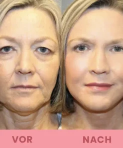 LIMETOW™ Kompakte Anti-Falten Stab