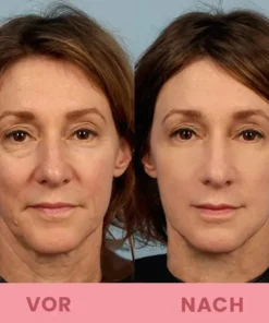 LIMETOW™ Kompakte Anti-Falten Stab