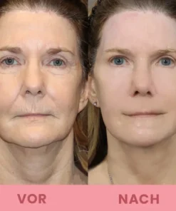 LIMETOW™ Kompakte Anti-Falten Stab