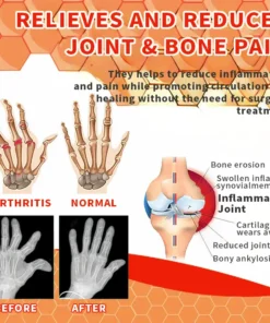 LOVILDS™ Bee Venom Advanced Joint And Bone Therapy Gel