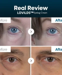 LOVILDS™ Eyebag Cream