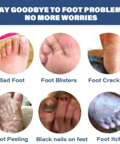 LOVILDS™ Medical Grade Nail Fungus Foot Strengthening Spray