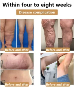 LOVILDS™ Ultrasonic Fat Burner and Detox Bracelet