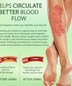 NESLEMY™ Circulation Max Tourmaline Fiber Leg Sleeves