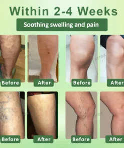 NESLEMY™ Circulation Max Tourmaline Fiber Leg Sleeves