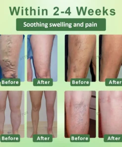 NESLEMY™ Circulation Max Tourmaline Fiber Leg Sleeves