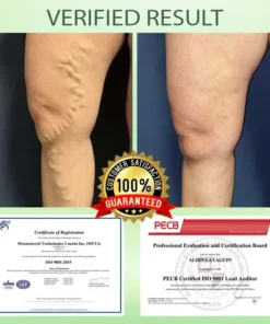 NESLEMY™ Circulation Max Tourmaline Fiber Leg Sleeves