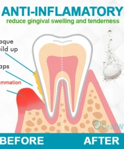 OralWiz™ Gum Care Tablets