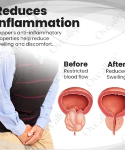 Oveallgo™ CopperMag Extra Wellness Therapy Ring