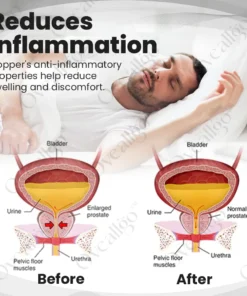 Oveallgo™ CopperMag Extra Wellness Therapy Ring