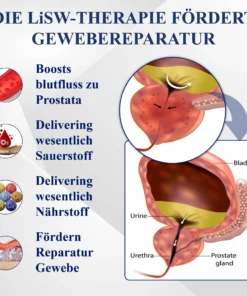 RICPIND™ LiSWT Handgelenkband zur Verbesserung der männlichen Gesundheit