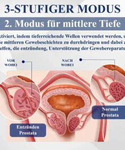 RICPIND™ LiSWT Handgelenkband zur Verbesserung der männlichen Gesundheit