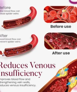 Seurico™Facial Vein Soothing Repair Cream