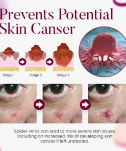 Seurico™Facial Vein Soothing Repair Cream