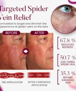 Seurico™Facial Vein Soothing Repair Cream