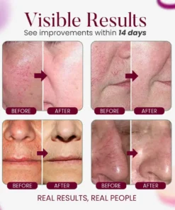 Seurico™Facial Vein Soothing Repair Cream