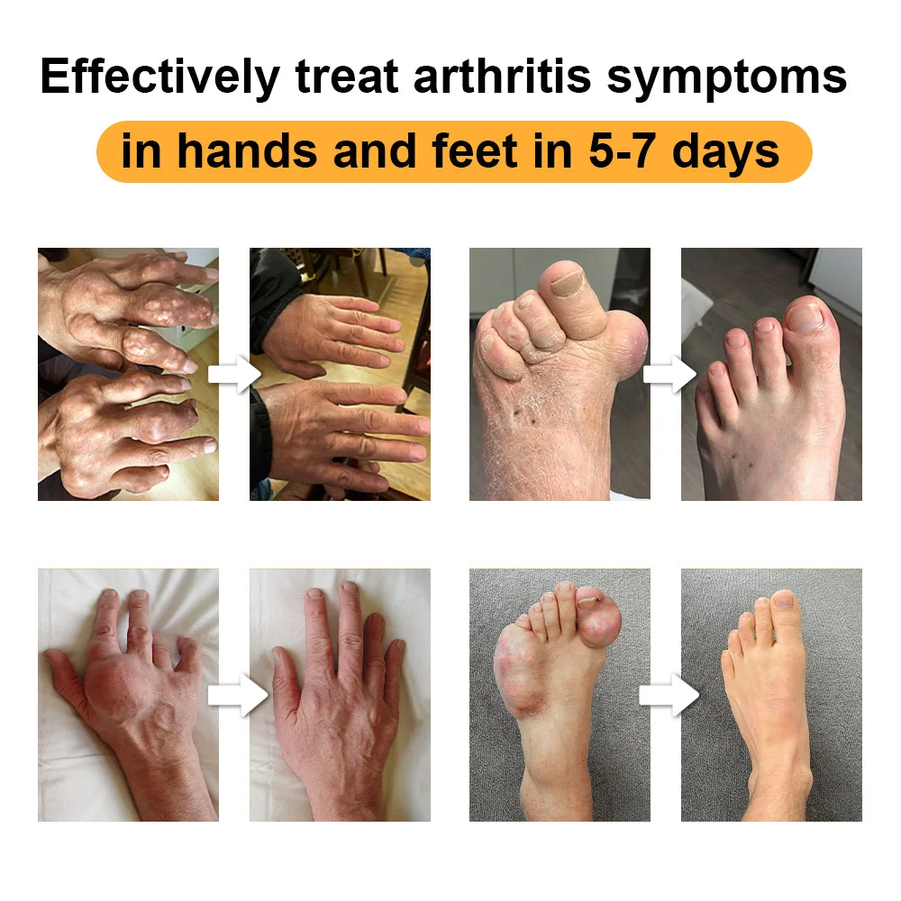 Seurico™ Schaumspray gegen Gelenk- und Knochenschmerzen