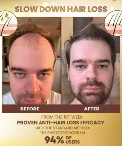 Stovis™ VitaGrow Biotin Hair&Beard Serum