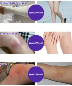 ZVLZVL™ Comfrey Arthritis Cream