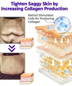 flysmus™ Firmaluxe Intensive Tightening Lotion