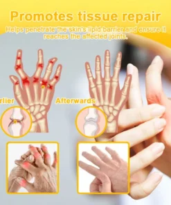 𝐁𝐕𝐇𝐌𝐑™ 𝐁𝐞𝐞 𝐕𝐞𝐧𝐨𝐦 𝐀𝐝𝐯𝐚𝐧𝐜𝐞𝐝 𝐉𝐨𝐢𝐧𝐭 𝐚𝐧𝐝 𝐁𝐨𝐧𝐞 𝐓𝐡𝐞𝐫𝐚𝐩𝐲 𝐂𝐫𝐞𝐚𝐦