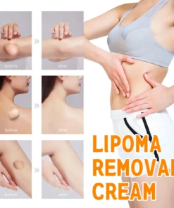 𝐂𝐫𝐨𝐚𝐢𝐞™ 𝐋𝐢𝐩𝐨𝐦𝐚 & 𝐖𝐚𝐫𝐭 𝐓𝐫𝐞𝐚𝐭𝐦𝐞𝐧𝐭 𝐂𝐫𝐞𝐚𝐦