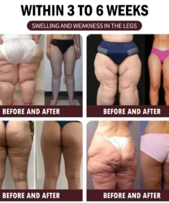 𝐎𝐲𝐢𝐤𝐞𝐲™ 𝐁𝐞𝐞 𝐕𝐞𝐧𝐨𝐦 & 𝐓𝐮𝐫𝐦𝐞𝐫𝐢𝐜 𝐀𝐫𝐭𝐡𝐫𝐢𝐭𝐢𝐬 𝐓𝐡𝐞𝐫𝐚𝐩𝐲 𝐂𝐫𝐞𝐚𝐦