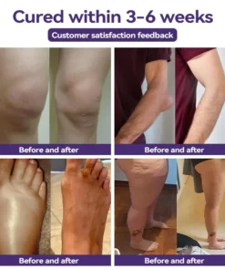 𝐎𝐲𝐢𝐤𝐞𝐲™ 𝐎𝐫𝐠𝐚𝐧𝐢𝐜 𝐇𝐞𝐫𝐛𝐚𝐥 𝐂𝐨𝐦𝐟𝐫𝐞𝐲 𝐎𝐢𝐧𝐭𝐦𝐞𝐧𝐭