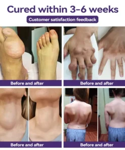 𝐎𝐲𝐢𝐤𝐞𝐲™ 𝐎𝐫𝐠𝐚𝐧𝐢𝐜 𝐇𝐞𝐫𝐛𝐚𝐥 𝐂𝐨𝐦𝐟𝐫𝐞𝐲 𝐎𝐢𝐧𝐭𝐦𝐞𝐧𝐭